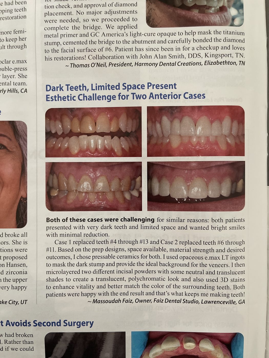 Dark teeth limited space case study